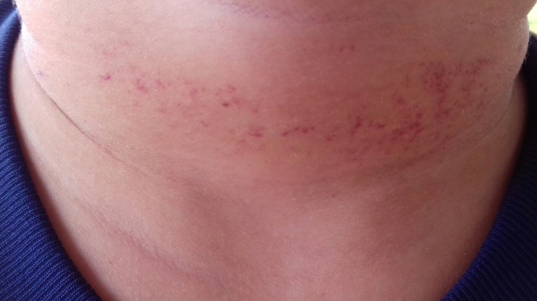 Aluno de apenas 9 anos de idade pode ter sofrido tentativa de homicídio em escola da rede particular de Açailândia