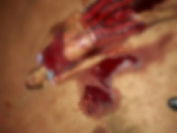 Homem é morto a facadas em Imperatriz