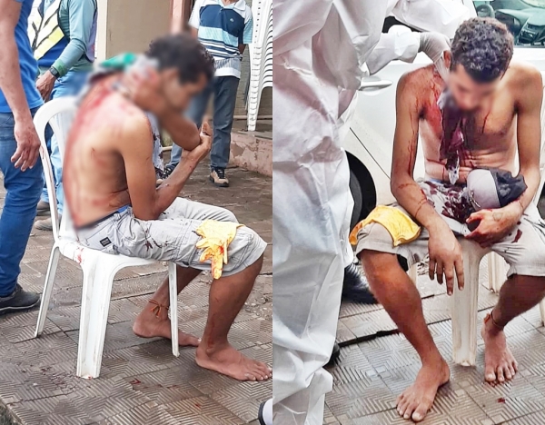 AÇAILÂNDIA – Homem sofre tentativa de homicídio no setor da rodoviária 