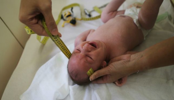Vírus bovino é encontrado em tecidos de bebês com microcefalia