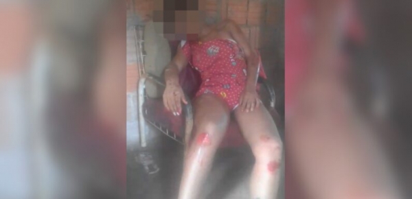 MARANHÃO - Jovem pula de carro em movimento durante tentativa de estupro em Buriticupu