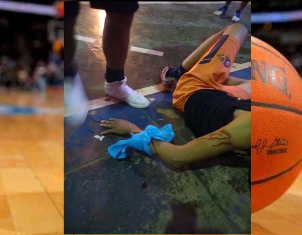 Jovem de Açailândia quebra o braço em acidente na estrutura da antiga quadra da SEDEL