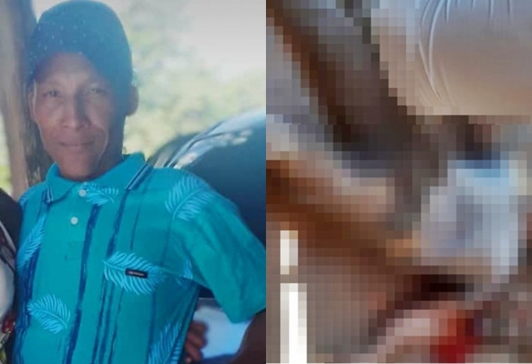 AÇAILÂNDIA - 34º Homicídio é registrado no município, a vítima um homem que foi morto na zona rural 