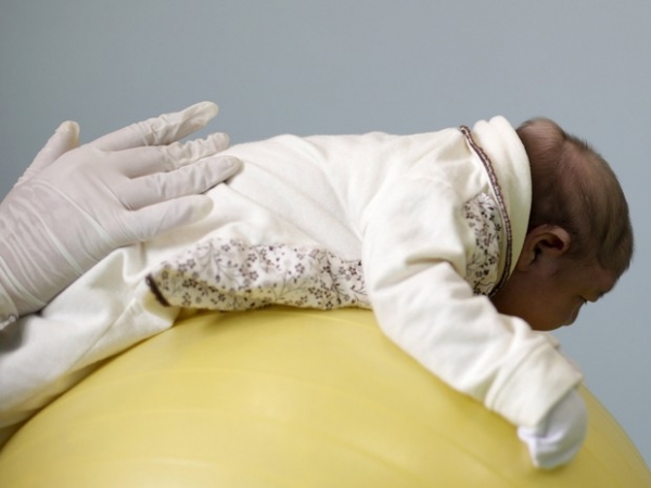 Maranhão tem 66 casos confirmados de microcefalia, diz SES