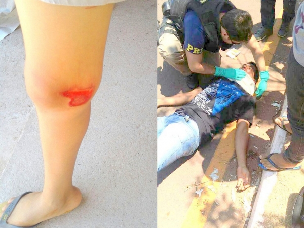 Dois acidente foram registrados na última segunda-feira em Açailândia  