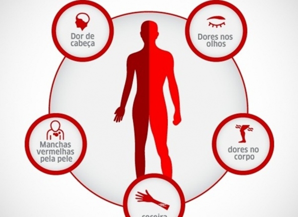 Estudo da Fiocruz aponta pernilongo como potencial transmissor do vírus Zika