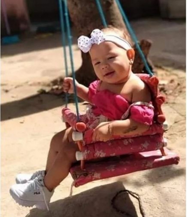 Morre criança de dois anos que teve corpo queimado em incêndio em Imperatriz