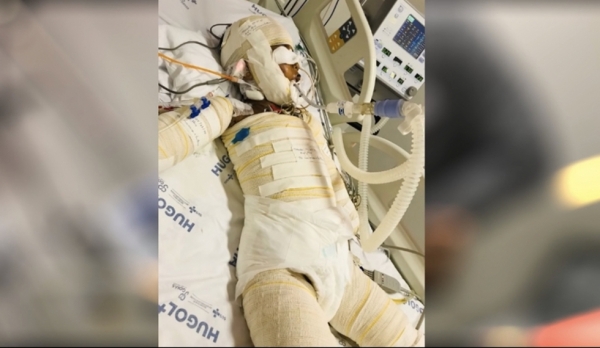 Na UTI do HUGOL, João Miguel continua em estado grave