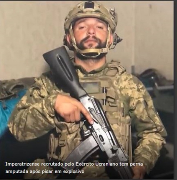 IMPERATRIZENSE RECRUTADO PELO EXÉRCITO UCRANIANO TEM PERNA AMPUTADA APÓS PISAR EM EXPLOSIVO