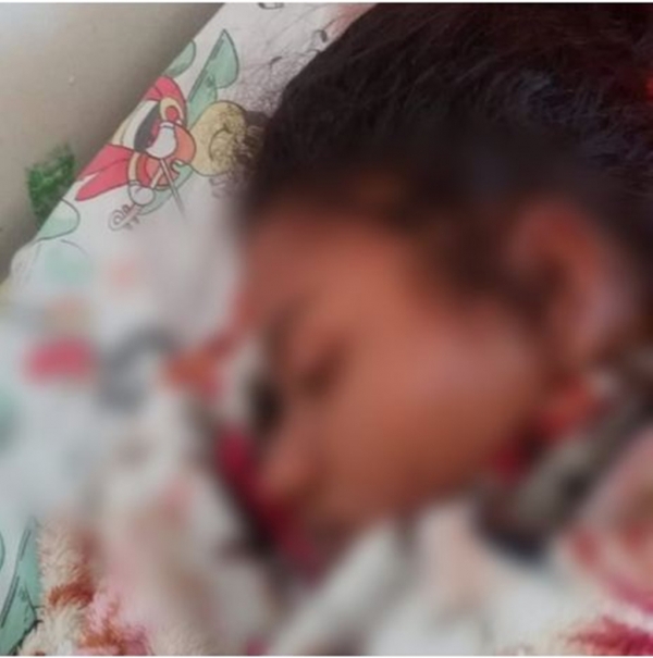 Com máquina do Socorrão sem funcionar, jovem pede ajuda para fazer tomografia