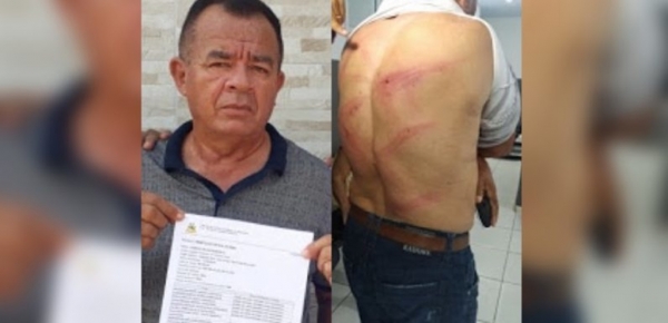 Vereador é espancado no Maranhão
