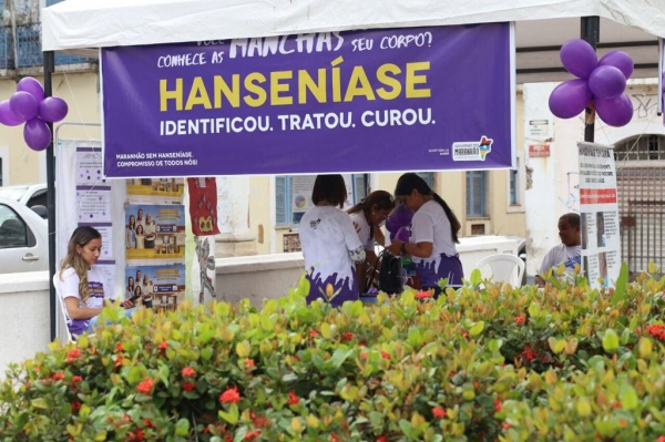 Governo reforça informação para avançar no controle da Hanseníase