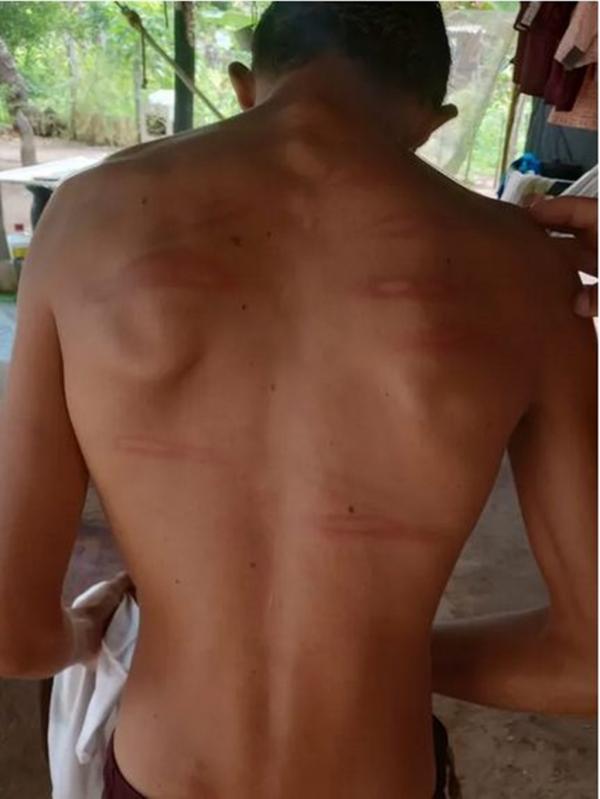 Homem é preso suspeito de torturar filho com deficiência intelectual, no Maranhão