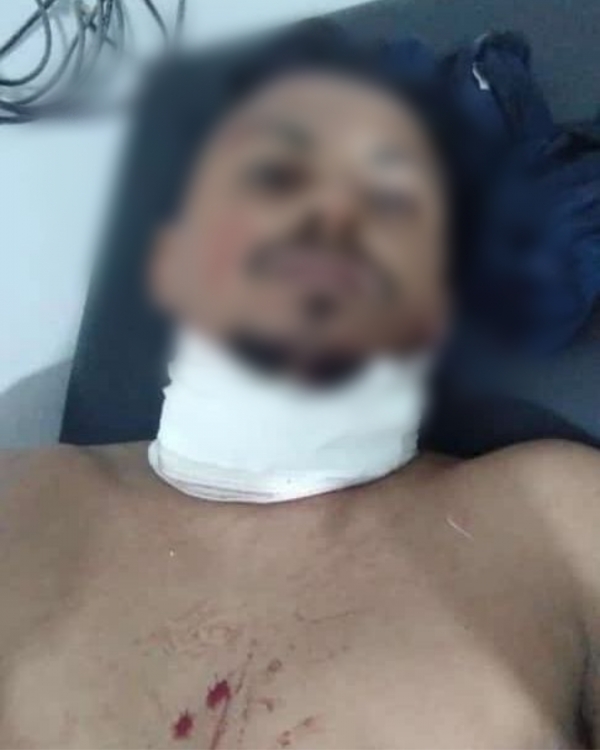 Homem passa por cirurgia após ter o pescoço cortado por linha de cerol em Senador La Rocque