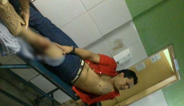 Cantor Stenio é baleado com um tiro durante apresentação, no Parque Santa Lúcia