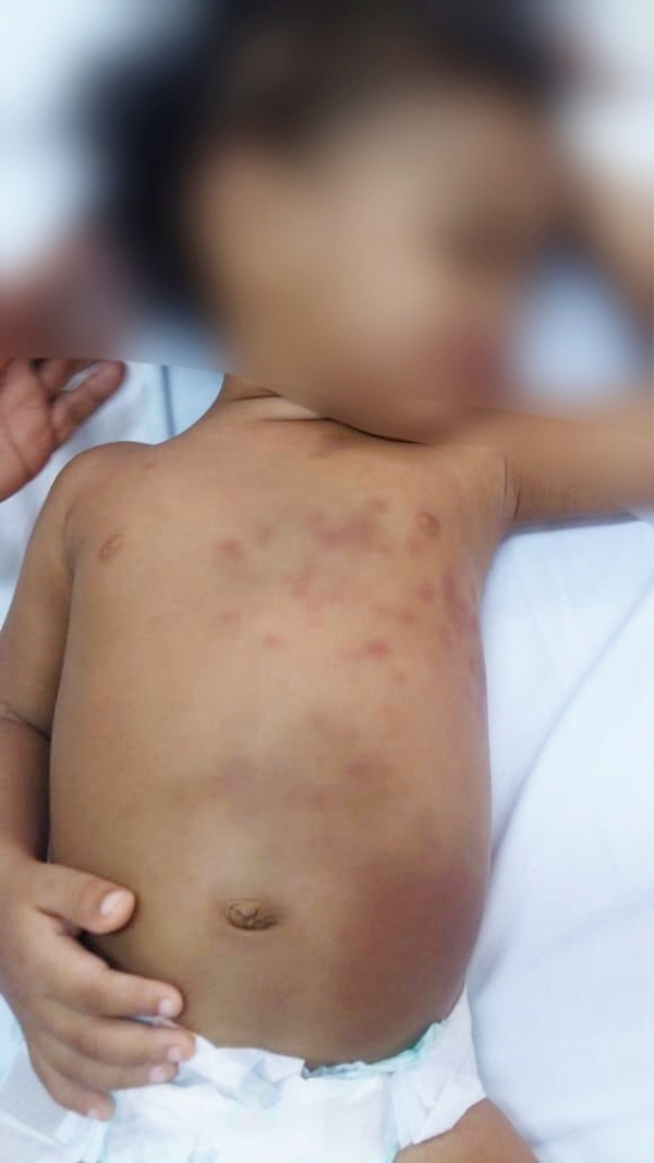 MARANHÃO -  Mãe é presa por maus-tratos e menina de dois anos confirma agressões: 'foi a mamãe'