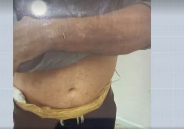 VÍDEO: CRIMINOSOS COLOCAM CINTO EXPLOSIVO EM GERENTE DE BANCO NO MA