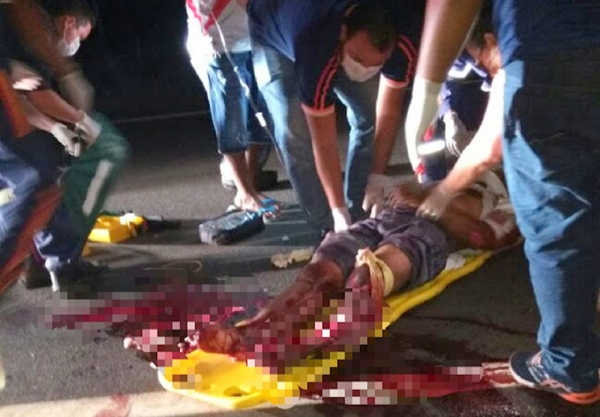 AÇAILÂNDIA  -  Colisão frontal na BR 010 deixa cinco pessoas feridas, duas em estado grave