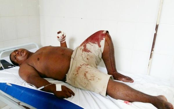 Homem é esfaqueado na rodoviária municipal de Açailândia