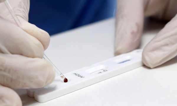 Covid-19: Brasil registra 51 mil casos e 842 mortes em 24 horas