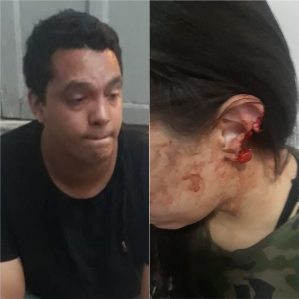 Homem é preso após morder e arrancar parte da orelha da esposa em Imperatriz, no Maranhão