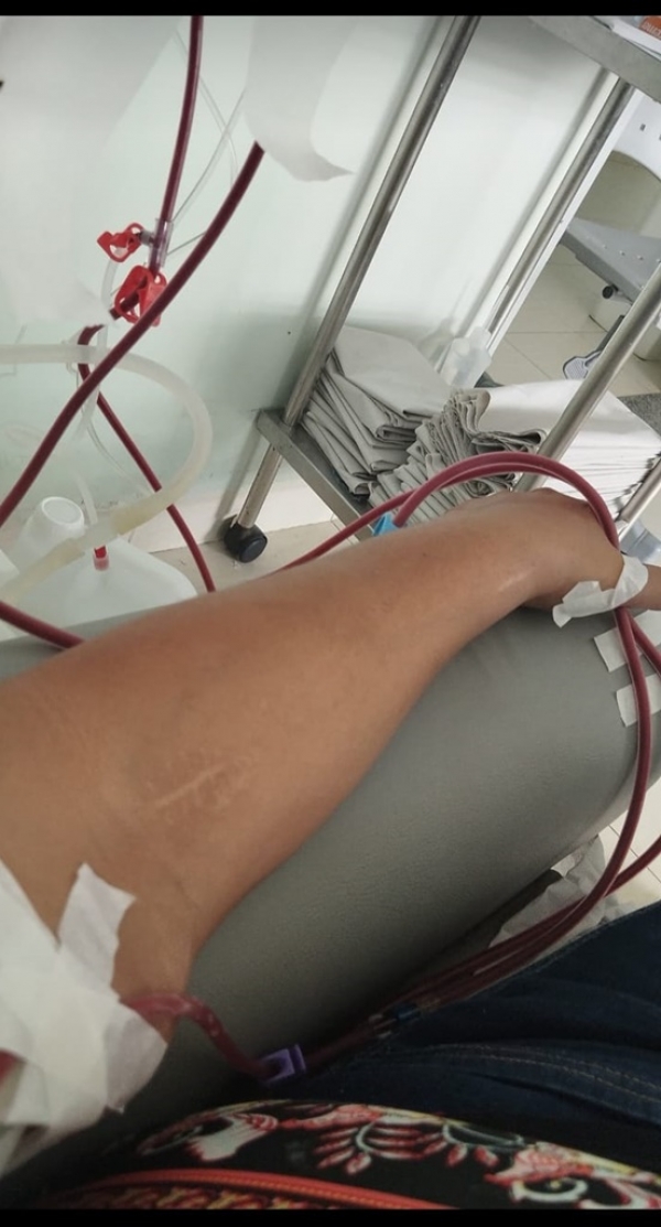 PACIENTES DE HEMODIÁLISE CONTINUAM DENUNCIANDO FALTA DE TRANSPORTE