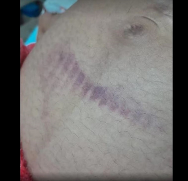 GRÁVIDA PERDE BEBÊ APÓS SER AGREDIDA DURANTE CAVALGADA, EM BURITIRANA