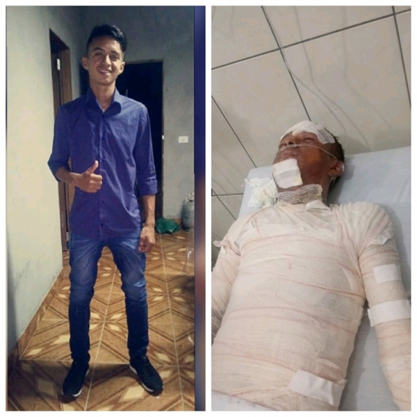  Bom Jesus das Selvas: mãe faz apelo para conseguir tratamento para o filho