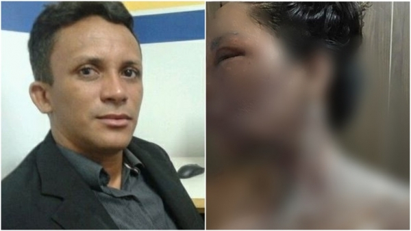 Marido acusado de queimar esposa com água quente é preso no Maranhão