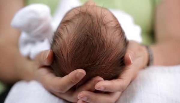 No Maranhão, microcefalia é confirmada em 99 bebês