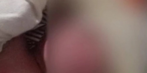 RECÉM-NASCIDO É ABANDONADO NO LIXO EM SÃO BENTO; MÃE FOI PRESA EM FLAGRANTE