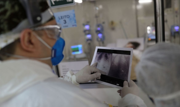 Covid-19: Brasil tem 11 milhões de casos e 266,3 mil mortes