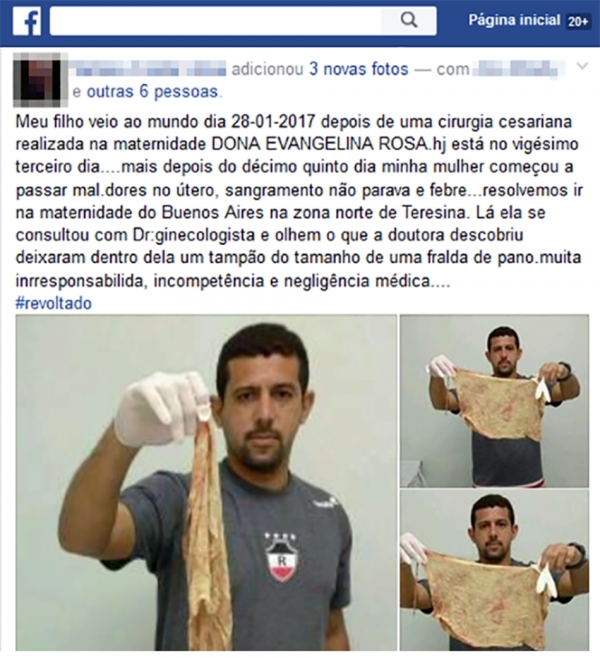 Médica encontra 'tampão' dentro de mulher no Piauí 20 dias após o parto