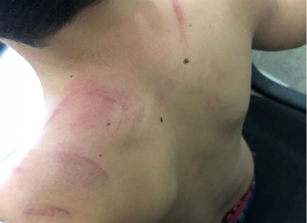 Homem é preso acusado de agredir criança de 5 anos na cidade de Imperatriz