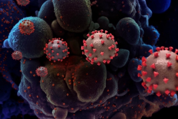 Maranhão chega a 413.530 casos e 10.818 mortes por Covid-19