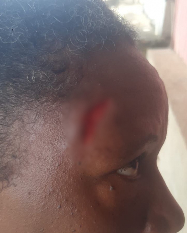 HOMEM AGREDIU MULHER COM UMA GARRAFADA NA CABEÇA, A VÍTIMA FOI LEVADA PARA O HOSPITAL E O AGRESSOR FOI PRESO.