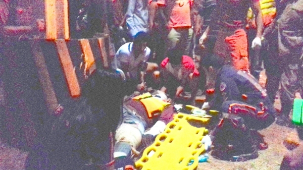 VÍDEO IMAGENS FORTES - AÇAILÂNDIA - Mototaxista clandestino sofre acidente com fratura exposta na BR- 222