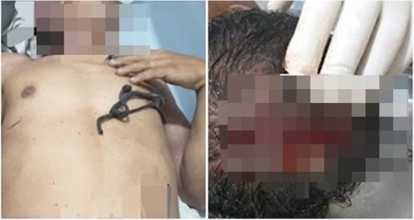 Troca de tiros termina em duplo homicídio em Chapadinha, no MA