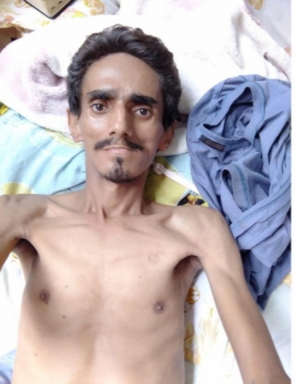 AÇAILÂNDIA - Naiton do Lava Jato morre na UTI de Açailândia após complicações renais