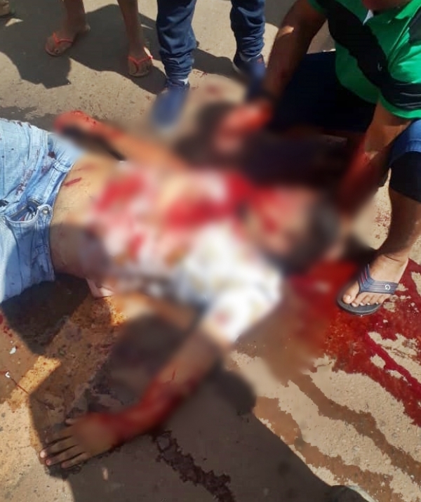 AÇAILÂNDIA URGENTE – Acidente grave na BR 222 deixa uma pessoa ferida