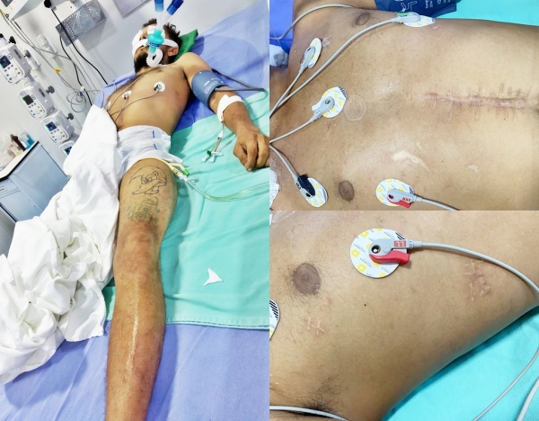 HOSPITAL MUNICIPAL DE AÇAILÂNDIA PROCURA FAMÍLIA DE PACIENTE SEM IDENTIFICAÇÃO INTERNADO EM ESTADO GRAVE