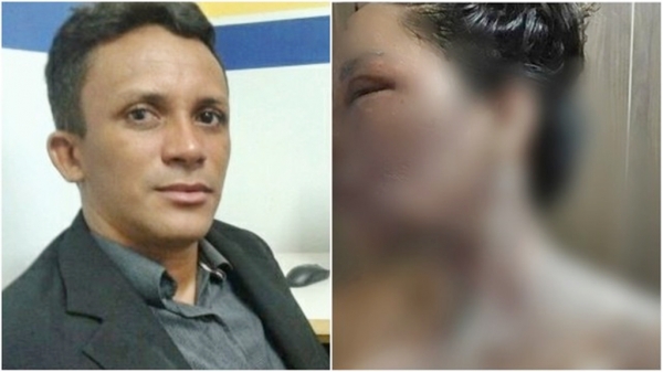 Marido acusado de jogar água quente contra vereadora pede para responder em liberdade, no Maranhão