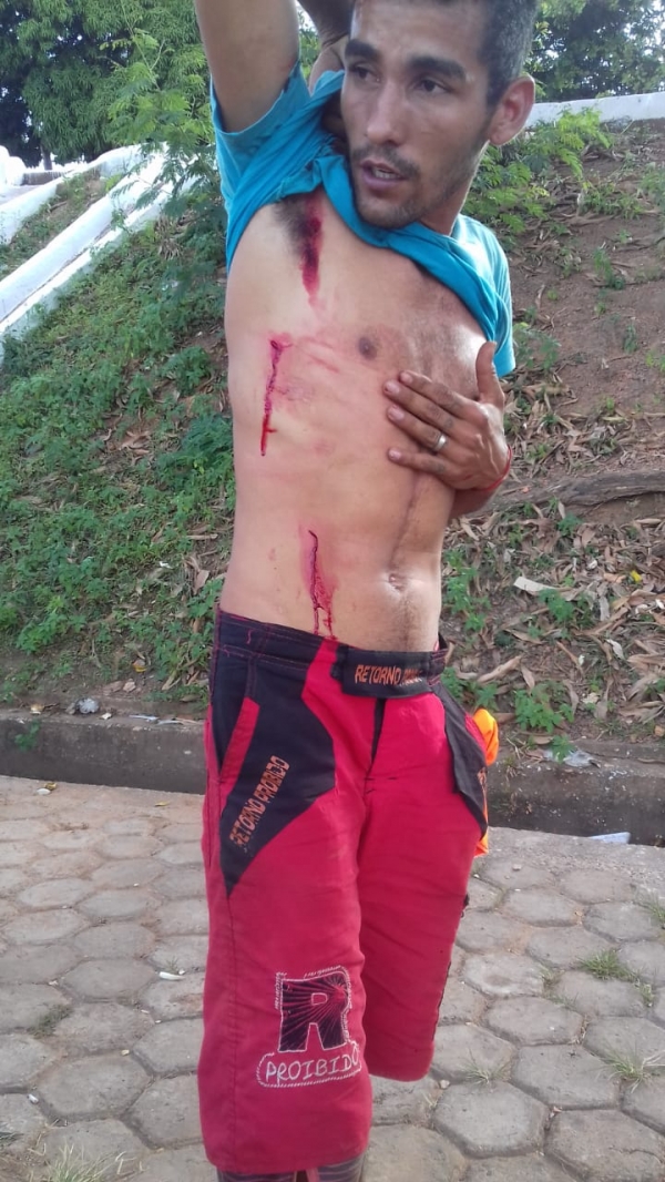 AÇAILÂNDIA URGENTE – Briga entre flanelinhas acaba deixando um bastante ferido no centro da cidade.