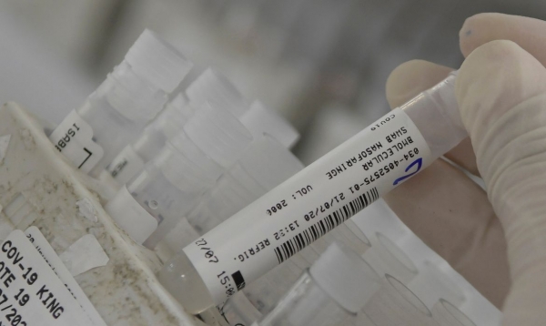 Brasil ultrapassa 7,2 milhões de casos de covid-19