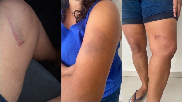 Mulher denuncia que foi torturada por seguranças dentro do Mix Mateus, após ser confundida, em São Luís