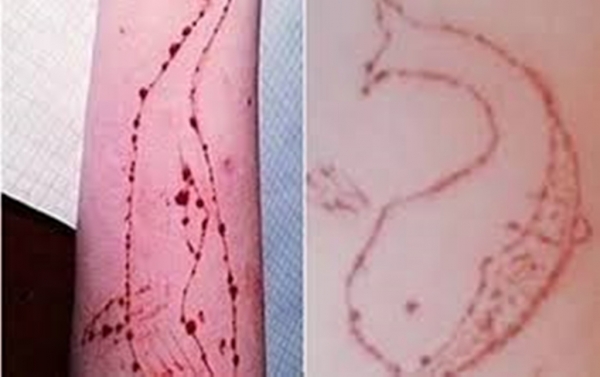 Senado aprova lei que criminaliza desafios que levam à automutilação