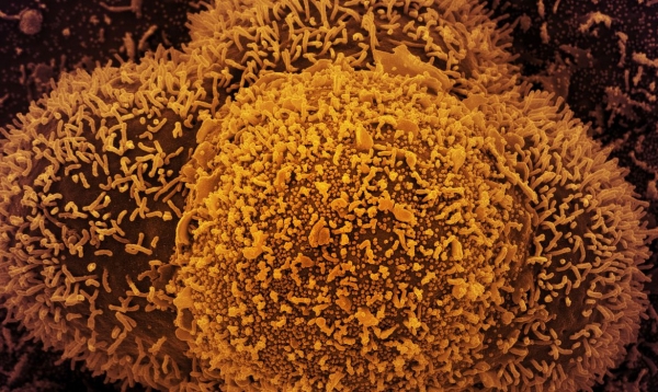 País tem 24.382 novos casos de covid-19 e 44 mortes em 24 horas