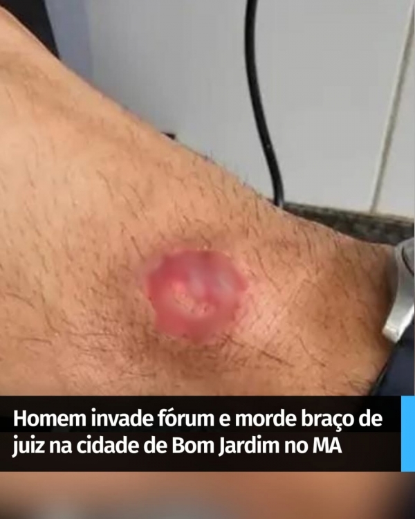 HOMEM INVADE FÓRUM E MORDE BRAÇO DE JUIZ NA CIDADE DE BOM JARDIM NO MA
