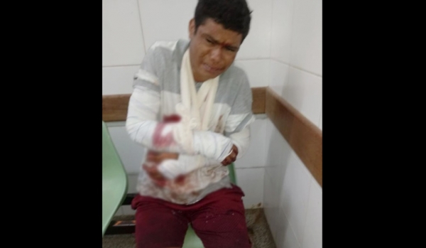 Suspeito de praticar assalto quebra os braços após tentar fugir da polícia