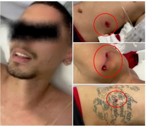 Jovem persegue motorista que atropelou namorada e acaba baleado em Codó